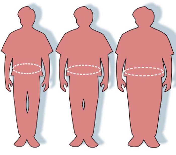 Степени ожирения: силуэты людей с нормальной, избыточной массой тела и с ожирением.